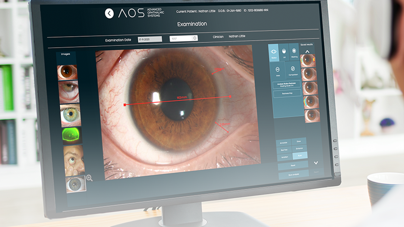 Managing contact lenses gets a fresh update with AOS. From baseline imaging assessment to troubleshooting, soft contact lenses to specialty fits, in-clinic and remote, your clinic will set the new standard of care.